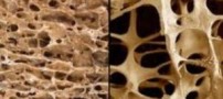 سه خوراکی خوشمزه علیه پوکی استخوان