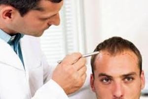 درباره کاشت موی طبیعی چه میدانید؟