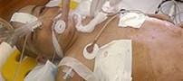 مرگ تلخ کودکی 5 ساله زیر شلاق‌ های مرگبار ناپدری