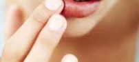 با خشکی و ترک لب چه کنیم؟