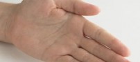 علت خارش کف دست چیست؟