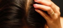 از شپش و مشکلات آن چه میدانید؟