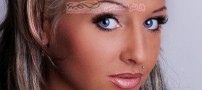 مرگ دختر 23 ساله پس از 6 عمل جراحی زیبایی