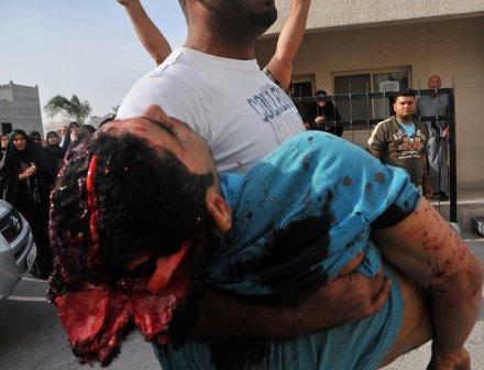 عکسهایی هولناک از جنایت سعودی ها در بحرین 16+