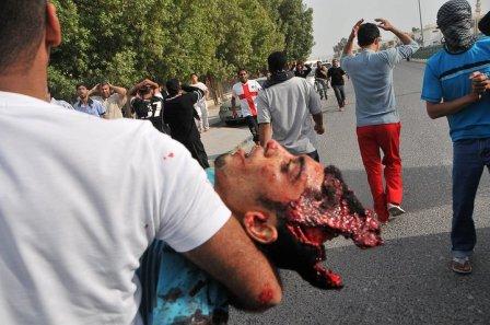 عکسهایی هولناک از جنایت سعودی ها در بحرین 16+