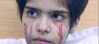 دختری بسیار عجیب که خون گریه میکند (+عکس)