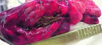 مردی که در بدنش درخت روییده است + عکس