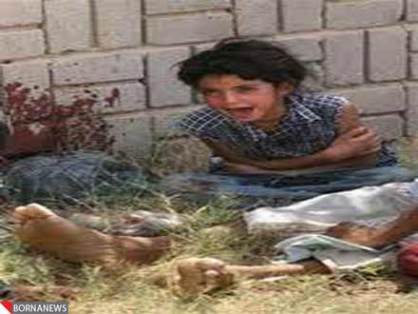 تجاوز جنسی به کودک 12 ساله در افغانستان+عکس