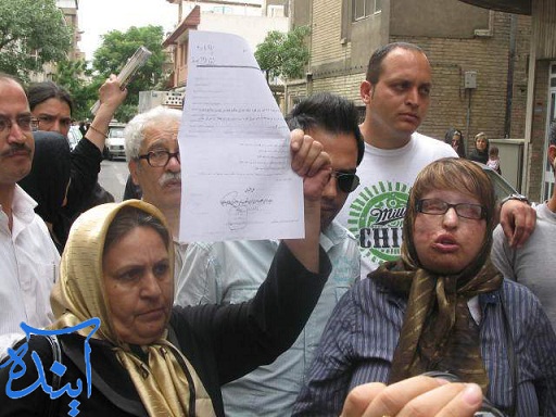 مجازات اسید پاش به تعویق افتاد + عکسهای دردناک مجازات اسید پاش به تعویق افتاد + عکسهای دردناک