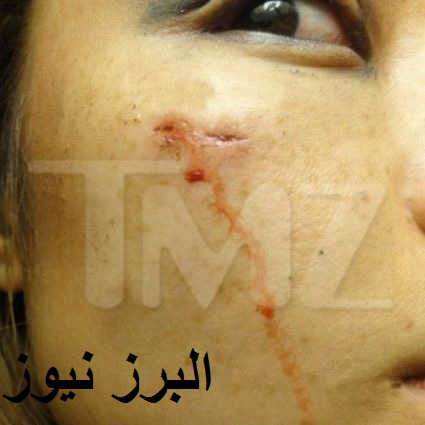 حمله به خواننده معروف و مجروح کردن وی +تصاویر