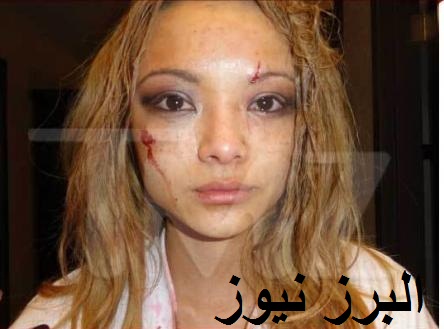 حمله به خواننده معروف و مجروح کردن وی +تصاویر
