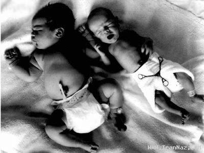 بزرگ ترین و سنگین ترین کودکان متولد شده +عکس