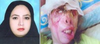 عکس های هولناک از اسید پاشی به یک مادر و فرزند