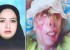 عکس های هولناک از اسید پاشی به یک مادر و فرزند
