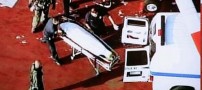 مرگ ملکه زیبایی و مدل مشهور بر اثر جراحی زیبایی!