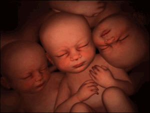 عکس هایی دیدنی از جنین های چند قلو داخل رحم
