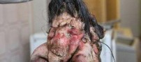 خارج کردن یک جنین از بدن پسر 22 ساله!!! (تصویری)
