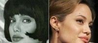 تفاوت چهره آنجلینا جولی در قبل و بعد جراحی زیبایی!