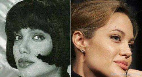تفاوت چهره آنجلینا جولی در قبل و بعد جراحی زیبایی!