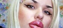 شهرت دختری بخاطر لب های بزرگ و عجیبش +عکس