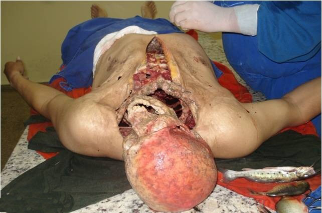 عکس های خورده شدن مردی توسط ماهی ( 16+)