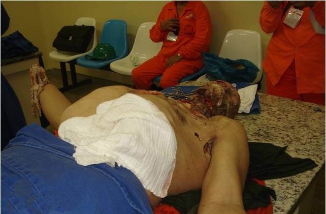 عکس های خورده شدن مردی توسط ماهی ( 16+)