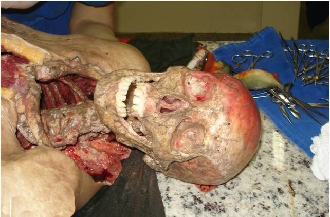 عکس های خورده شدن مردی توسط ماهی ( 16+)
