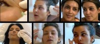 عکس های لو رفته از زن مشهور هنگام تزریق بوتاکس