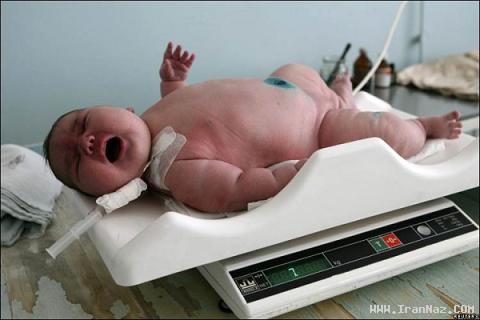 تولد سنگین ترین نوزاد جهان با 7 کیلوگرم وزن! +عکس