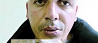 مردی که دهان خود را با نخ و سوزن دوخت!!+ عکس