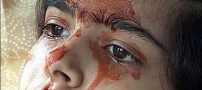 دختر 14 ساله و عجیبی که خون گریه می‌کند +تصاویر