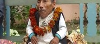 مردی عجیب با 72 سال سن و 12 کیلو وزن!! +عکس