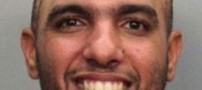 زندگی باورنکردنی با مغز و جمجمه سر نصفه +عکس