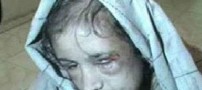 شکنجه دردناک یک نو عروس 15 ساله افغان +عکس