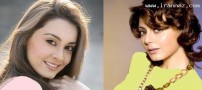 عکس های زنان بازیگر بالیوود قبل و بعد جراحی زیبایی