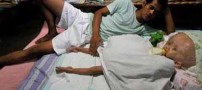 دختری عجیب وباورنکردنی با سر 1 متری !! + عکس