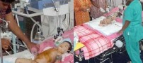جدا شدن دوقلو های به هم چسبیده هندی! +تصاویر