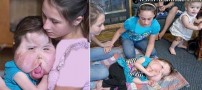 دختری چهار ساله با گونه هایی عجیب و خارق العاده!