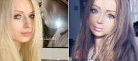 عکسهای جدید زیباترین دختر با بیش از 200عمل زیبایی