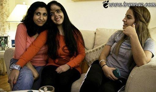 بریدن گوش و بینی این خانم توسط شوهرش! (عکس) بریدن گوش و بینی این خانم توسط شوهرش! (عکس)
