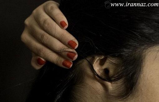 بریدن گوش و بینی این خانم توسط شوهرش! (عکس)