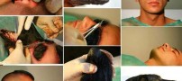عکس هایی باورنکردنی از پیوند صورت سگ به انسان!