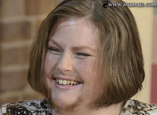 زنی که 16 سال موهای صورتش را اصلاح نکرد (عکس)