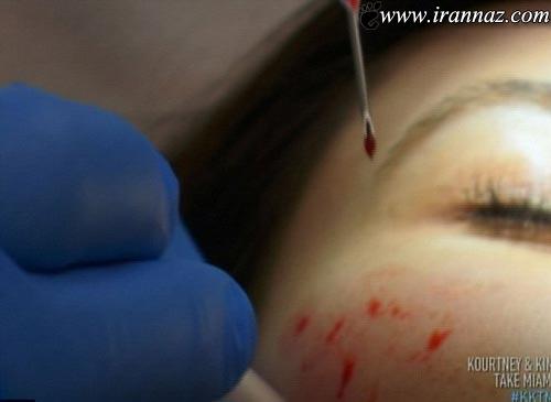 اقدام بسیار عجیب کیم کارداشیان روی پوست صورتش اقدام بسیار عجیب کیم کارداشیان روی پوست صورتش