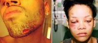 ماجرای حمله ی کریس براون و ریحانا! (عکس حادثه)