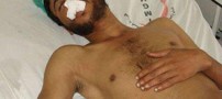 این مرد برای توهین نکردن به همسرش زبان خود را برید!