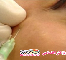 عکسهای زن هالیوودی هنگام تزریق بوتاکس!!