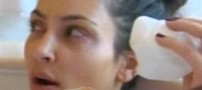 عکسهای زن هالیوودی هنگام تزریق بوتاکس!!