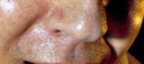 بفرمایید شام (البته اگه حالتون بد نمیشه)
